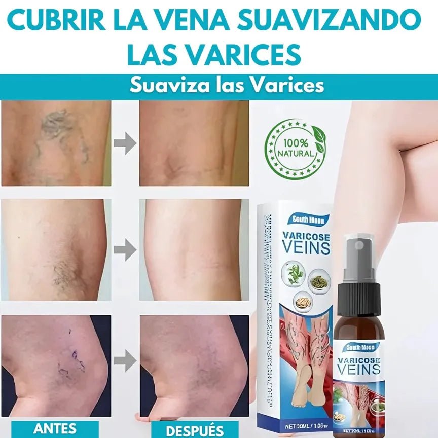 Spray Anti - Varices 100% Natural - Ecutienda.store
